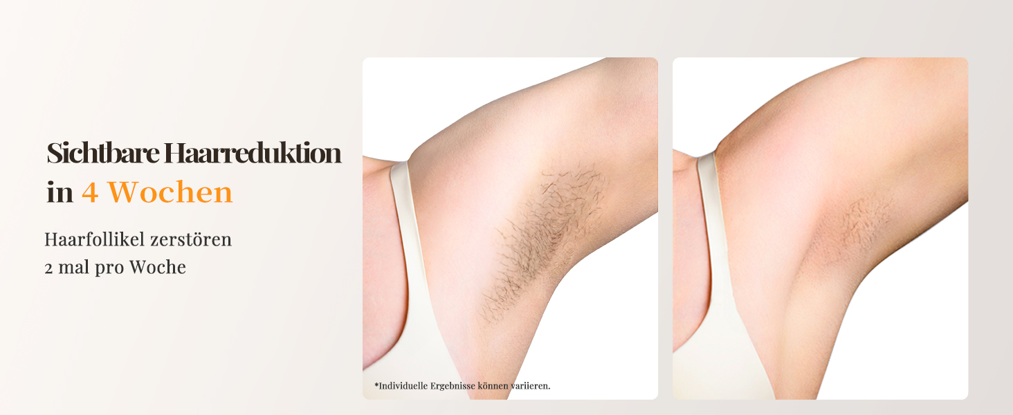 Пристрій для епіляції IPL з охолодженням, 9 рівнів потужності, 999900 імпульсів світла, безболісна епіляція вдома для обличчя, тіла, пахв та ніг (білий)