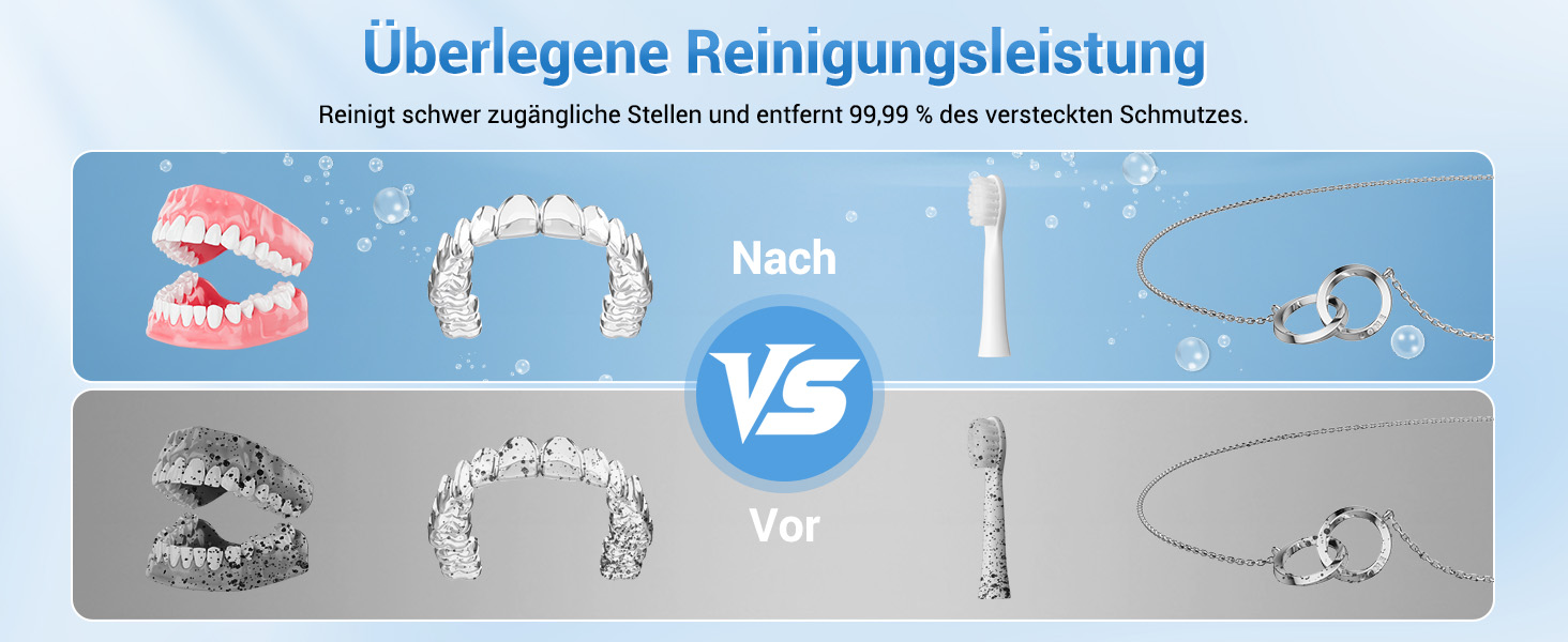 Ультразвуковий очищувач 48000Hz з УФ-дезінфекцією для зубних кап, брекетів, протезів та ювелірних виробів - 300 мл, 24 Вт