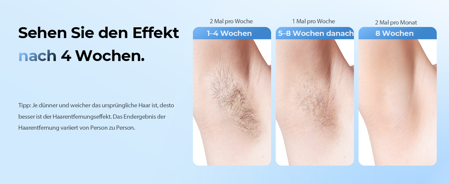 Пристрій для епіляції IPL з охолодженням, 21J та 9 рівнів потужності, 999,900 імпульсів, для жінок, тіло, ноги, зона бікіні, під пахвами