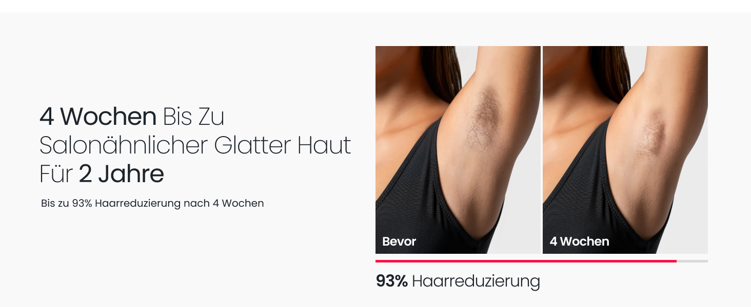 Прилад для епіляції IPL 22J, 78W, з охолодженням сапфіром, для дому, для обличчя, бікіні, пахв, блакитний