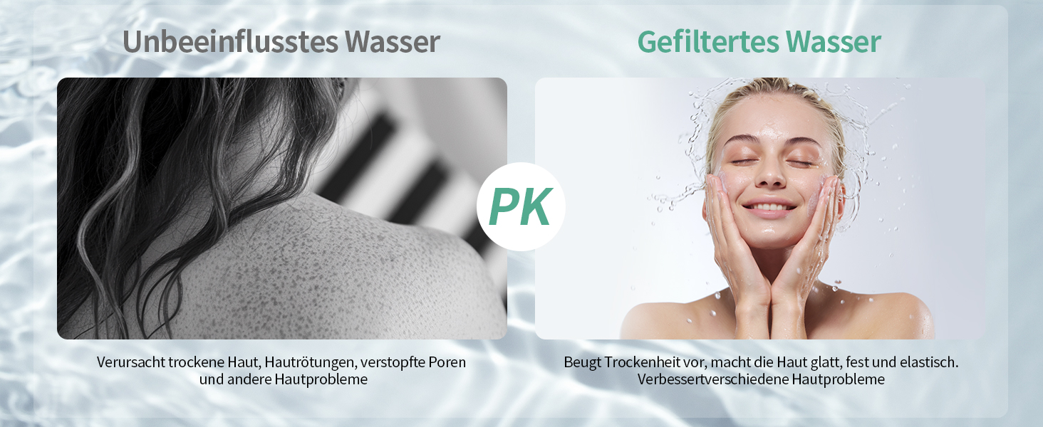 Душова лійка SR SUN RISE з фільтром, шланг та картриджі, 9 режимів, високий тиск, для жорсткої води, видаляє хлор, важкі метали, бактерії, чорний колір