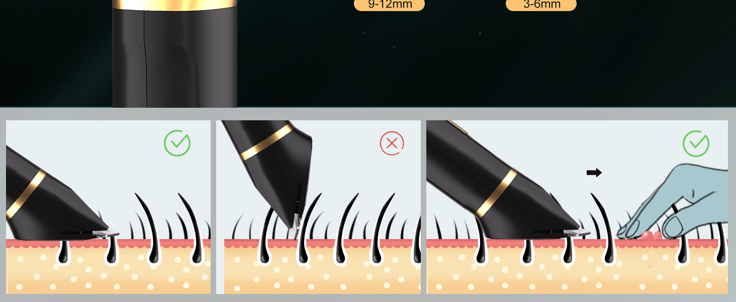 Електричний триммер для чоловіків 3-в-1 Intimrasierer: триммер для носа, обличчя та тіла, IPX7, чорний