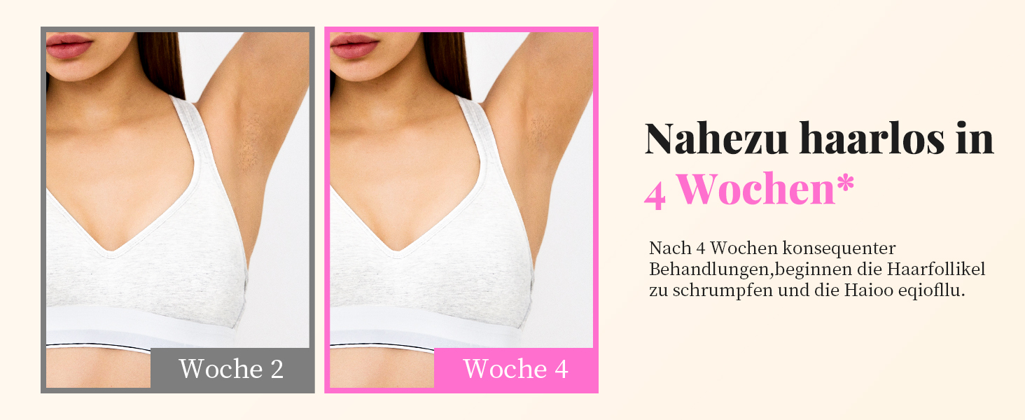 Пристрій для епіляції IPL Haarlosy - безболісна епіляція лазером, для дому, 9 рівнів, захист шкіри, для жінок та чоловіків, для обличчя, бікіні, тіла, білий (рожевий)