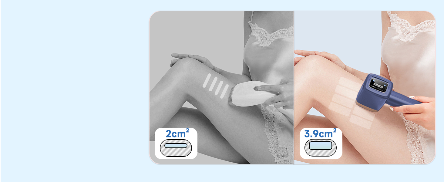 Пристрій для епіляції IPL MLAY: Швидка та безболісна епіляція лазером для обличчя, тіла та зони бікіні (для чоловіків та жінок)