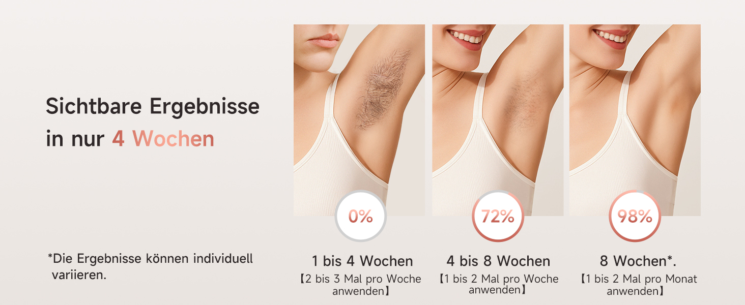 IPL пристрій для епіляції Haarlosy: 999,900 імпульсів, 3 функції, 9 рівнів, для чоловіків та жінок, безболісна епіляція тіла, обличчя, бікіні