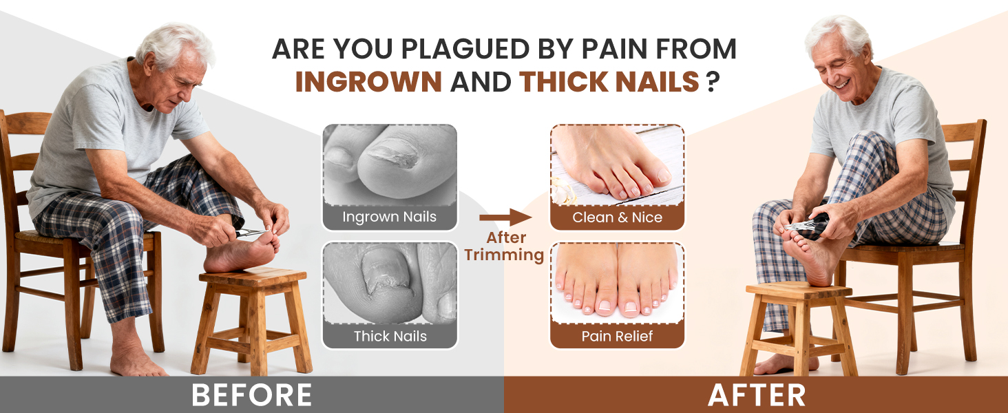 Кусачки для нігтів для літніх людей з товстими нігтями Zehennagelknipser: професійні кусачки з гострим вигнутим лезом та пилкою, нержавіюча сталь