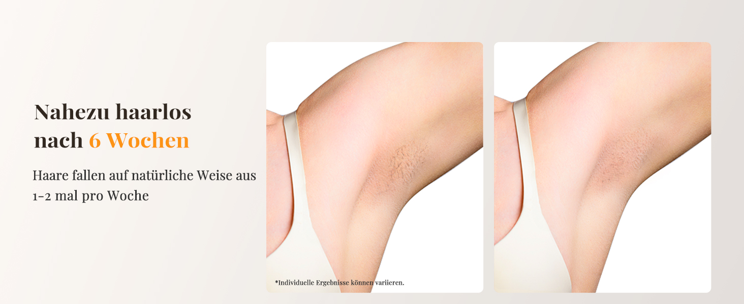 Пристрій для епіляції IPL з охолодженням, 9 рівнів потужності, 999900 імпульсів світла, безболісна епіляція вдома для обличчя, тіла, пахв та ніг (білий)