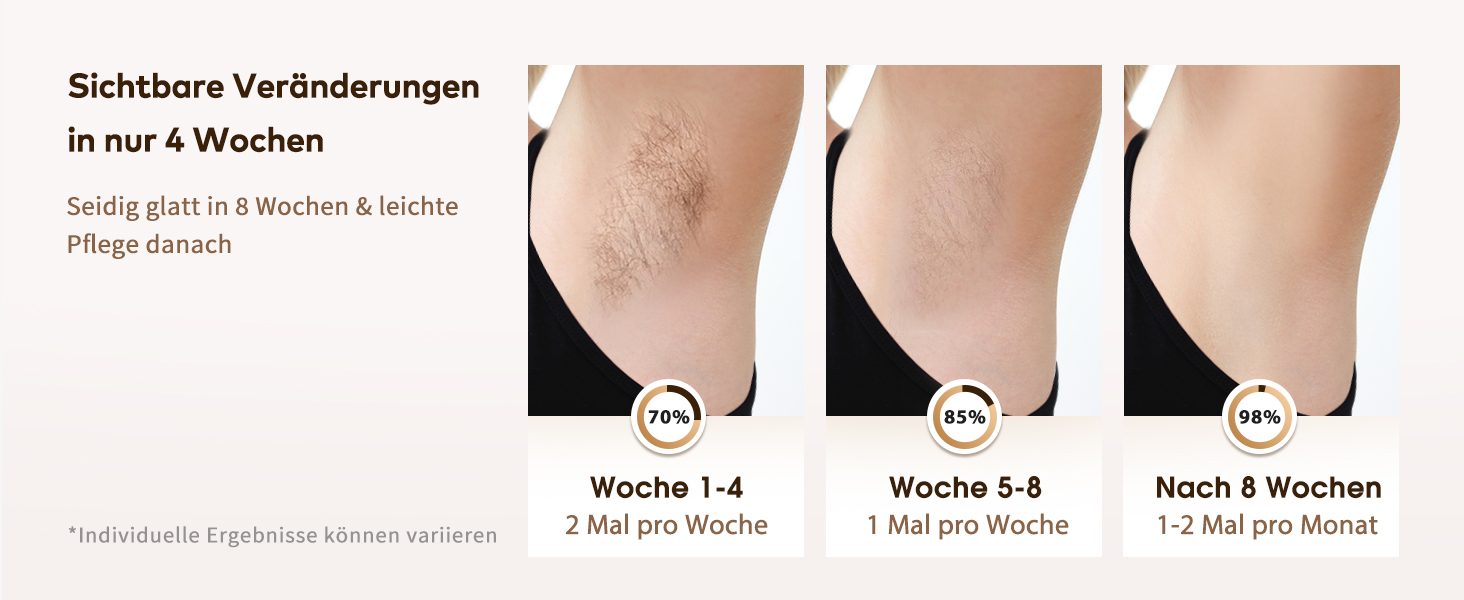 Пристрій для епіляції IPL Haarlosy 3-в-1: HR/SC/RA, 999 900 імпульсів, 9 рівнів енергії, безболісна епіляція для чоловіків та жінок, для тіла