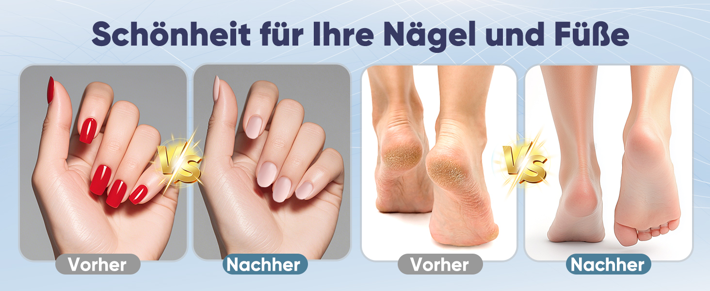 Електричний набір для манікюру Nagelfräser: 13 насадок, 5 швидкостей, 35000 обертів/хв, для гелю та акрилу