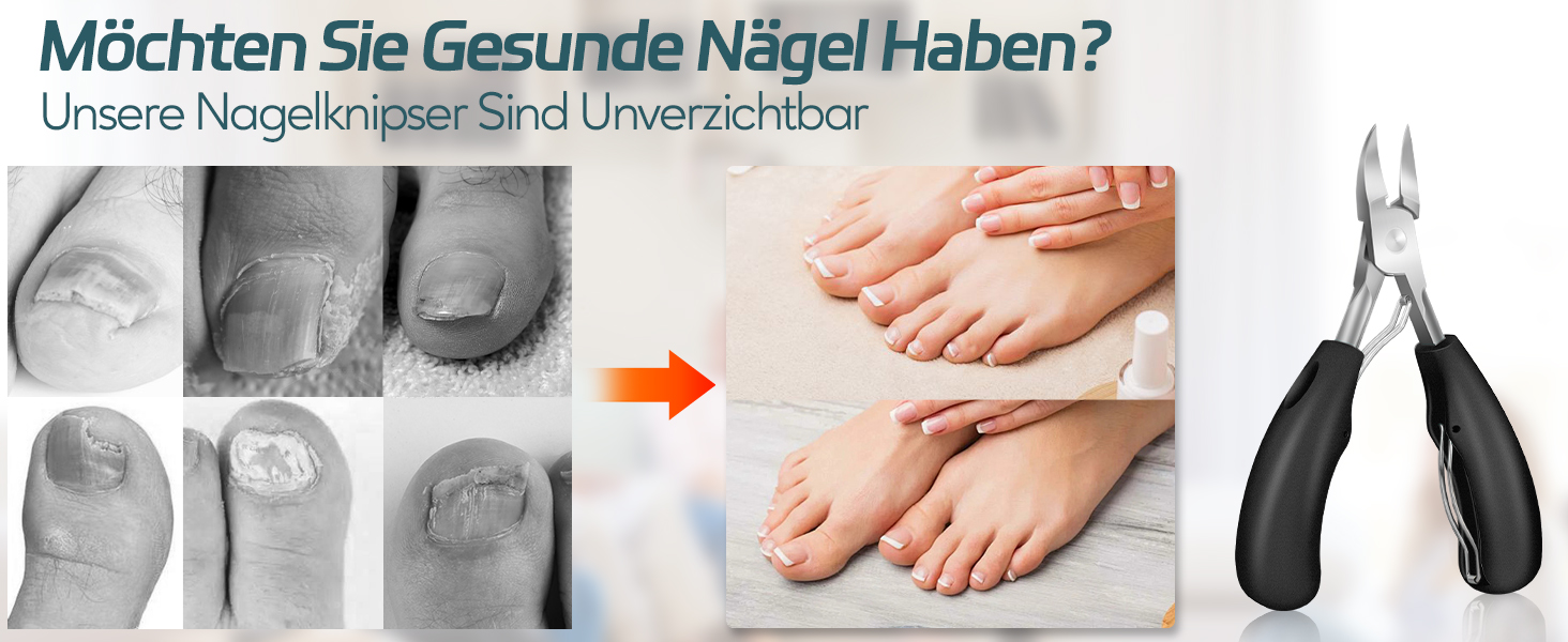 Набір для манікюру та педикюру Softale: професійний набір для догляду за нігтями, видалення врослих та твердих мозолів, 6 предметів