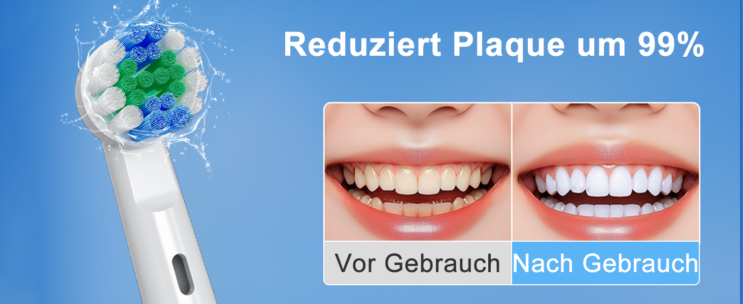 Електрична зубна щітка Rotierende для дорослих з 8 насадками, 3 режимами чищення, акумулятором на 50 днів та смарт-таймером 2 хв - Чорна