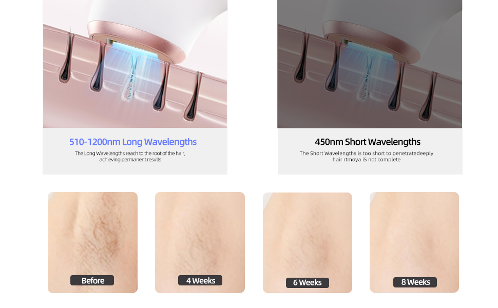 Пристрій для епіляції IPL TZWM 24J Turbo – безшумний, з адаптером 48W, 9 рівнів потужності, швидка епіляція за 0,5с, технологія Filament