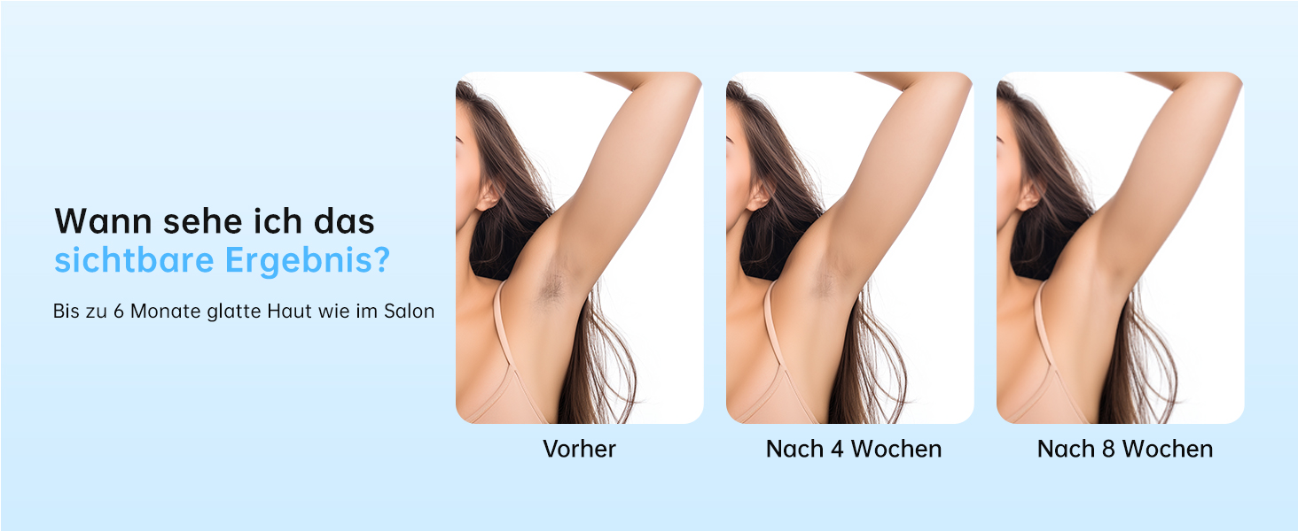 Пристрій для епіляції IPL з лазером та охолодженням, необмежена кількість імпульсів, довжина хвилі 600 нм, для жінок та чоловіків, обличчя, бікіні, руки, ноги, тіло, Rose