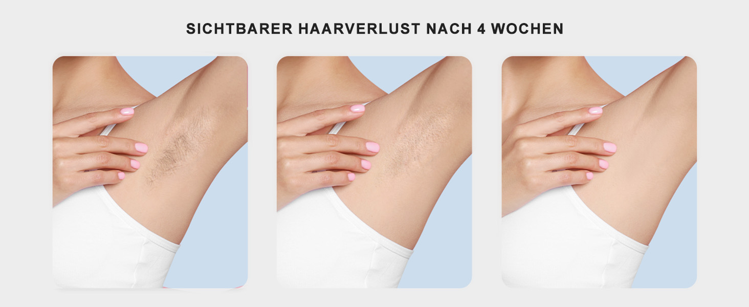 Пристрій для епіляції IPL NALONE, лазерне видалення волосся, 999 999 імпульсів, для жінок та чоловіків, 1200 нм, 2 режими, болюча епіляція для всього тіла, білий (золотий)