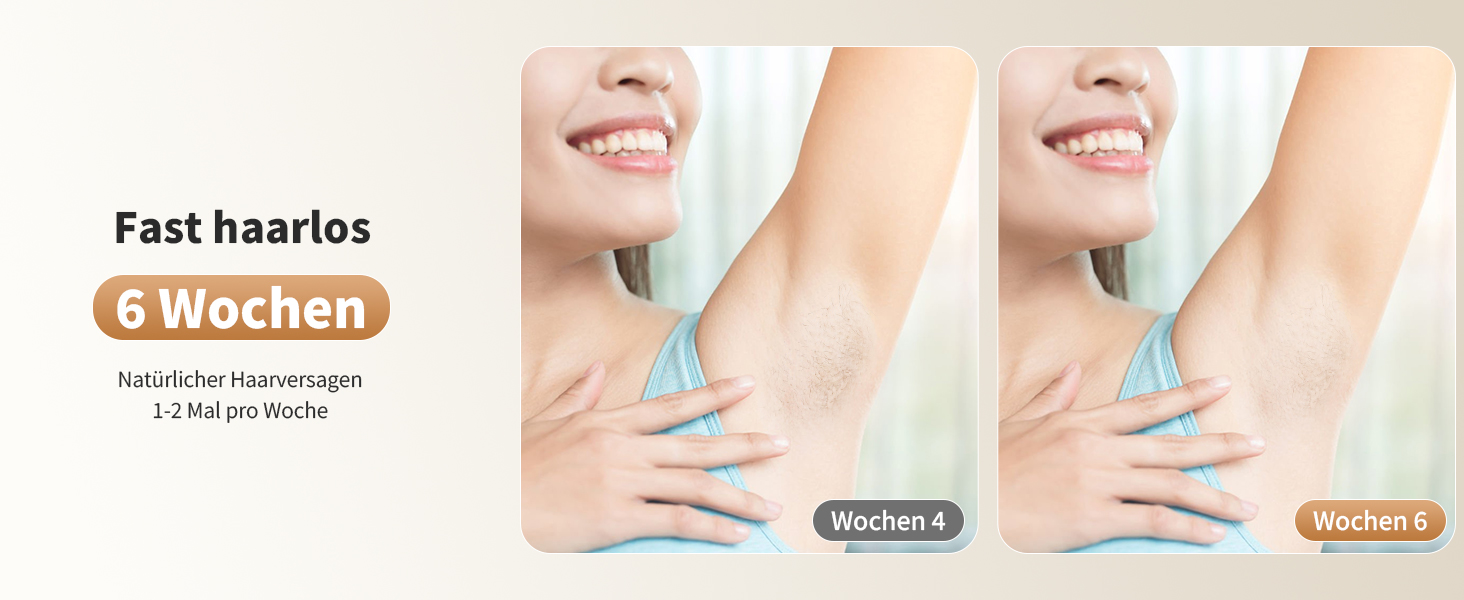 Пристрій для епіляції NIKYJM IPL з лазером, безболісна епіляція, 3 функції (HR/SC/RA), 9 рівнів, 999 999 імпульсів для дому, для всього тіла