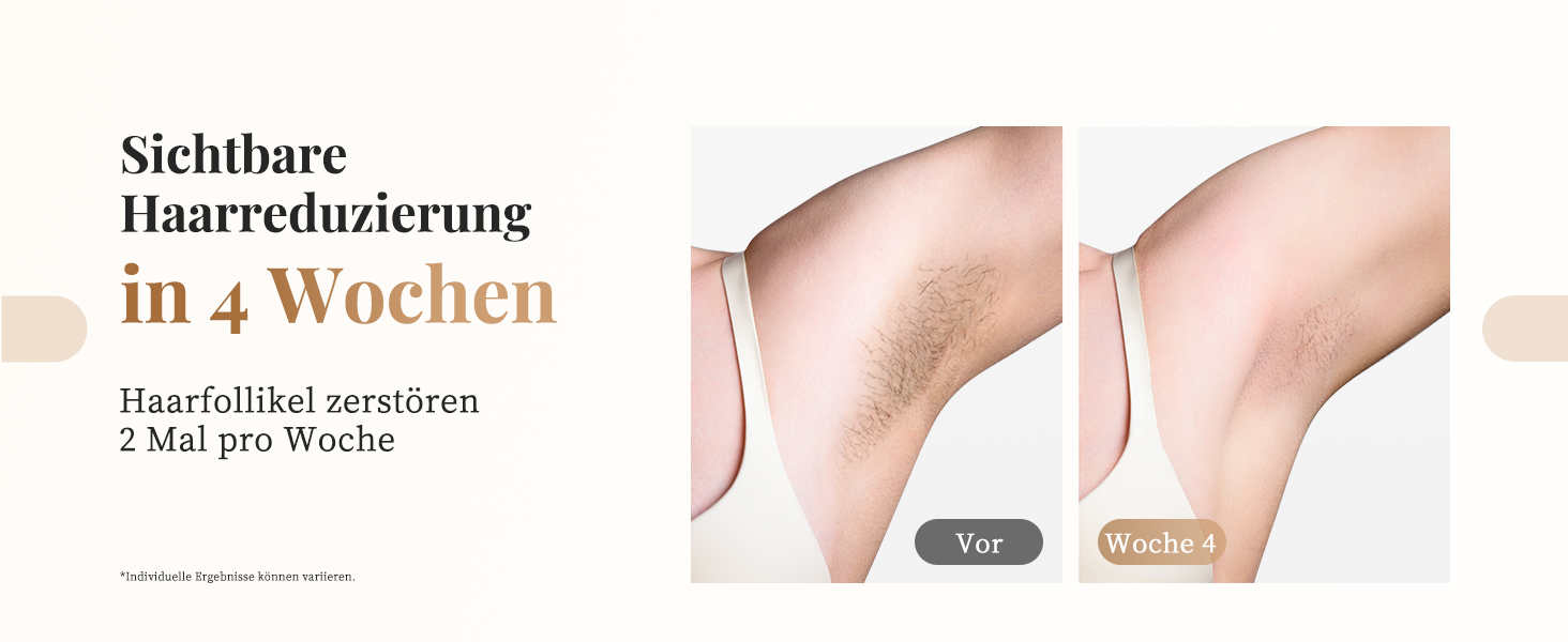 Пристрій для епіляції IPL Haarlosy - безболісна епіляція вдома для жінок та чоловіків, 9 рівнів, 999,900 імпульсів, 3 функції (HR/SC/RA), для тіла, ніг, зони бікіні, під пахвами, Platin